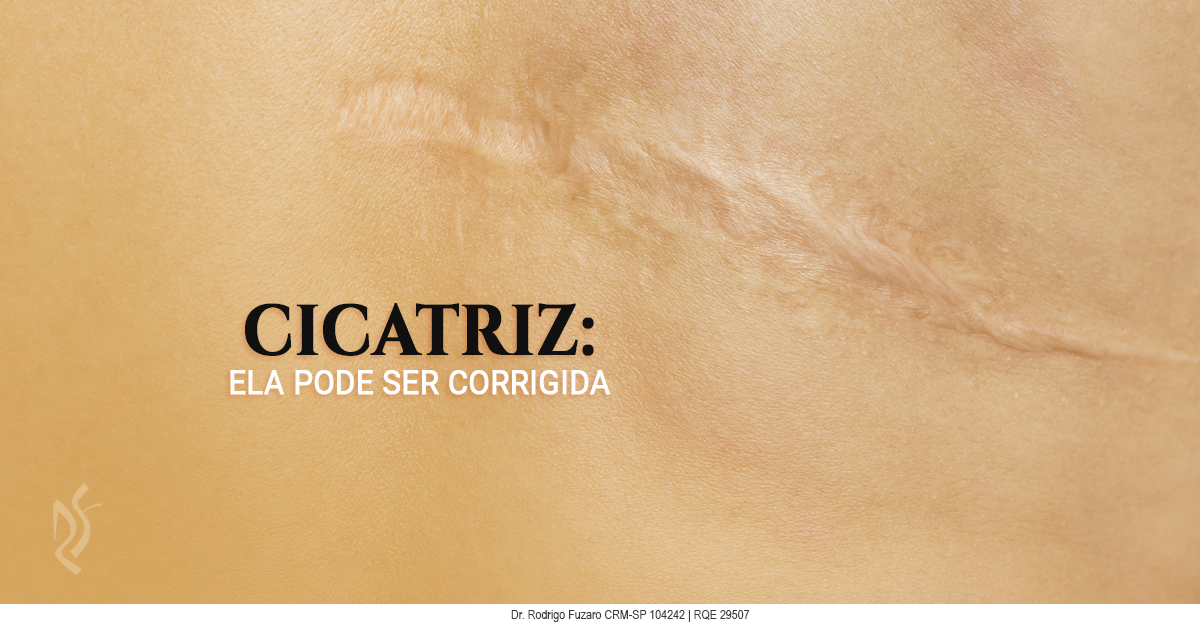 Correção de cicatriz — tratamentos para cicatrizes atróficas, hipertróficas e queloides na Clínica Fuzaro