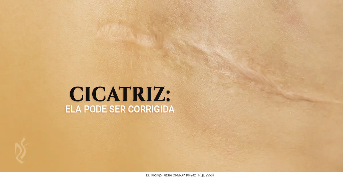 Correção de cicatriz — tratamentos para cicatrizes atróficas, hipertróficas e queloides na Clínica Fuzaro