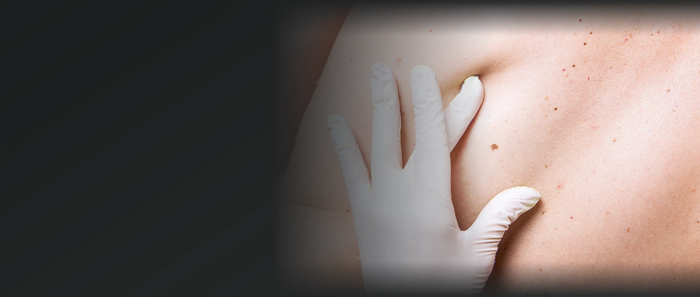 Exame dermatológico da pele para avaliação de pintas e lesões